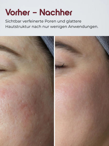 Reis-Peeling Serum