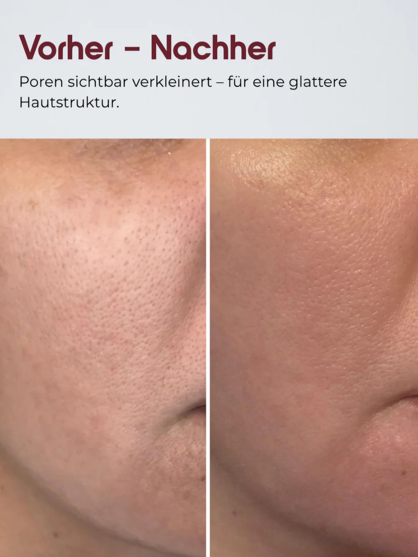 Reis-Peeling Serum