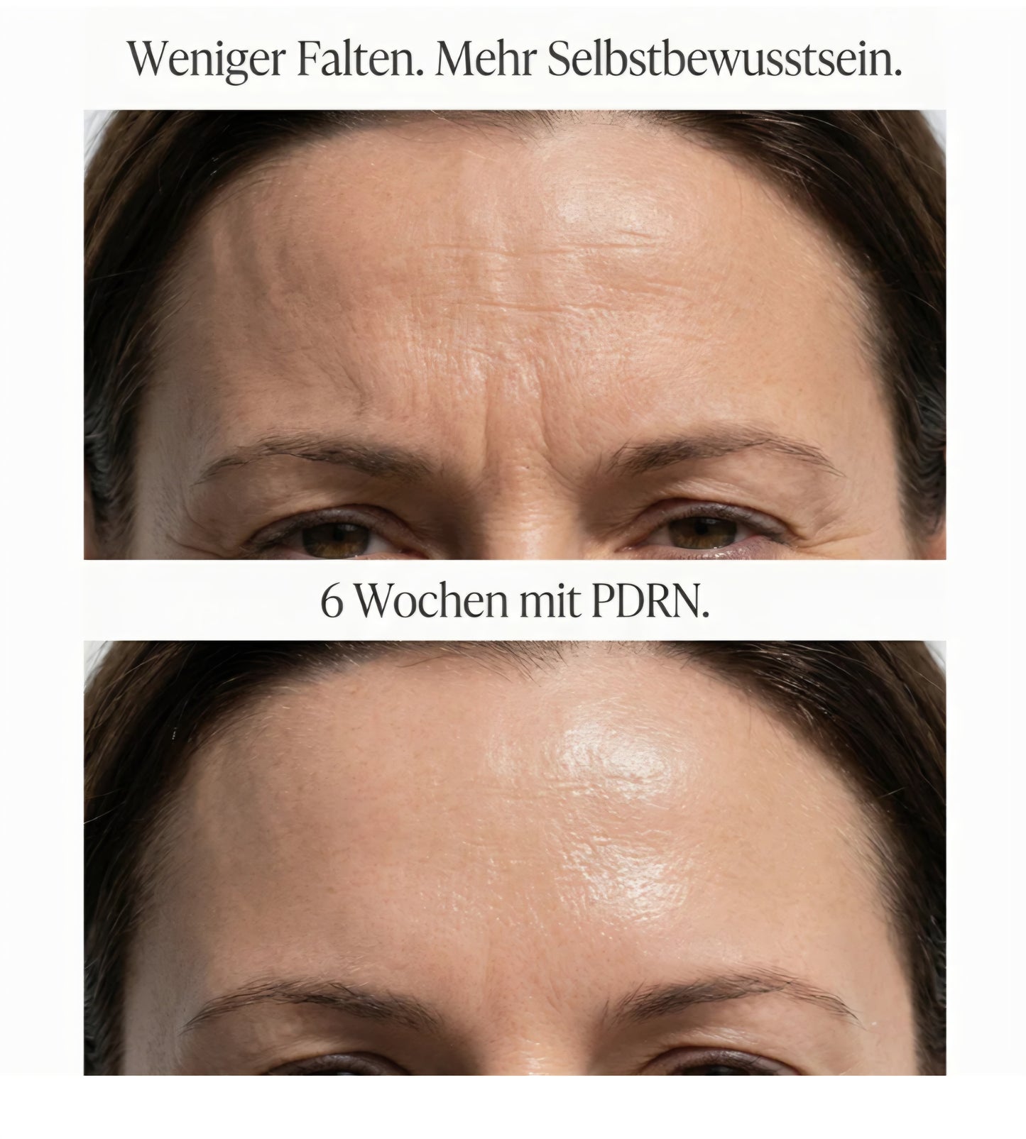 PDRN Vitamin Glow Boosting Ampoule (Salmon-DNA)