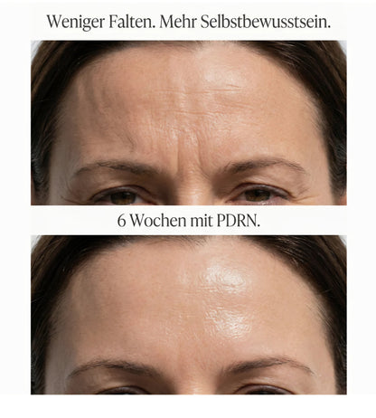 PDRN Vitamin Glow Boosting Ampoule (Salmon-DNA)
