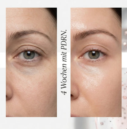 PDRN Vitamin Glow Boosting Ampoule (Salmon-DNA)